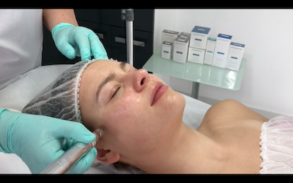 Dermapen