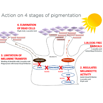 Overview on Melasma and other Hyperpigmentations Using TCA PEEL with M ...