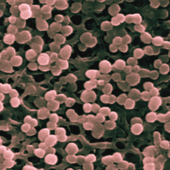 Salinococcus Lysate Filtrate